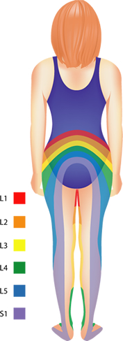 sciatica pain